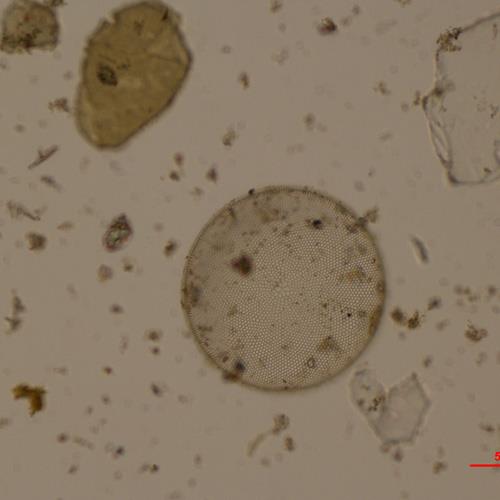 星脐圆筛藻.jpg 星脐圆筛藻.jpg