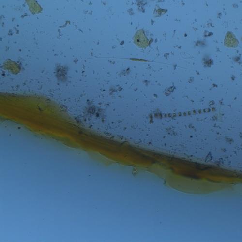 新月菱形藻.jpg 新月菱形藻.jpg