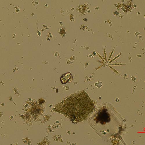 星杆藻.jpg 星杆藻.jpg