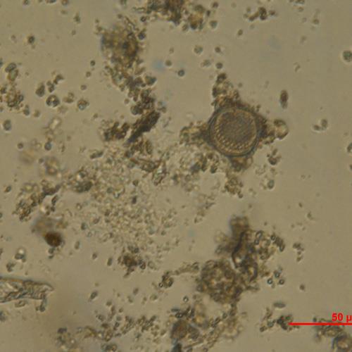 有翼圆筛藻.jpg 有翼圆筛藻.jpg