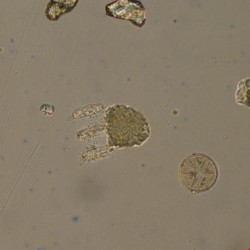 圆海链藻.jpg 圆海链藻.jpg